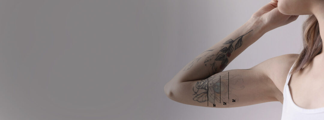 infinity-laser-banner-2